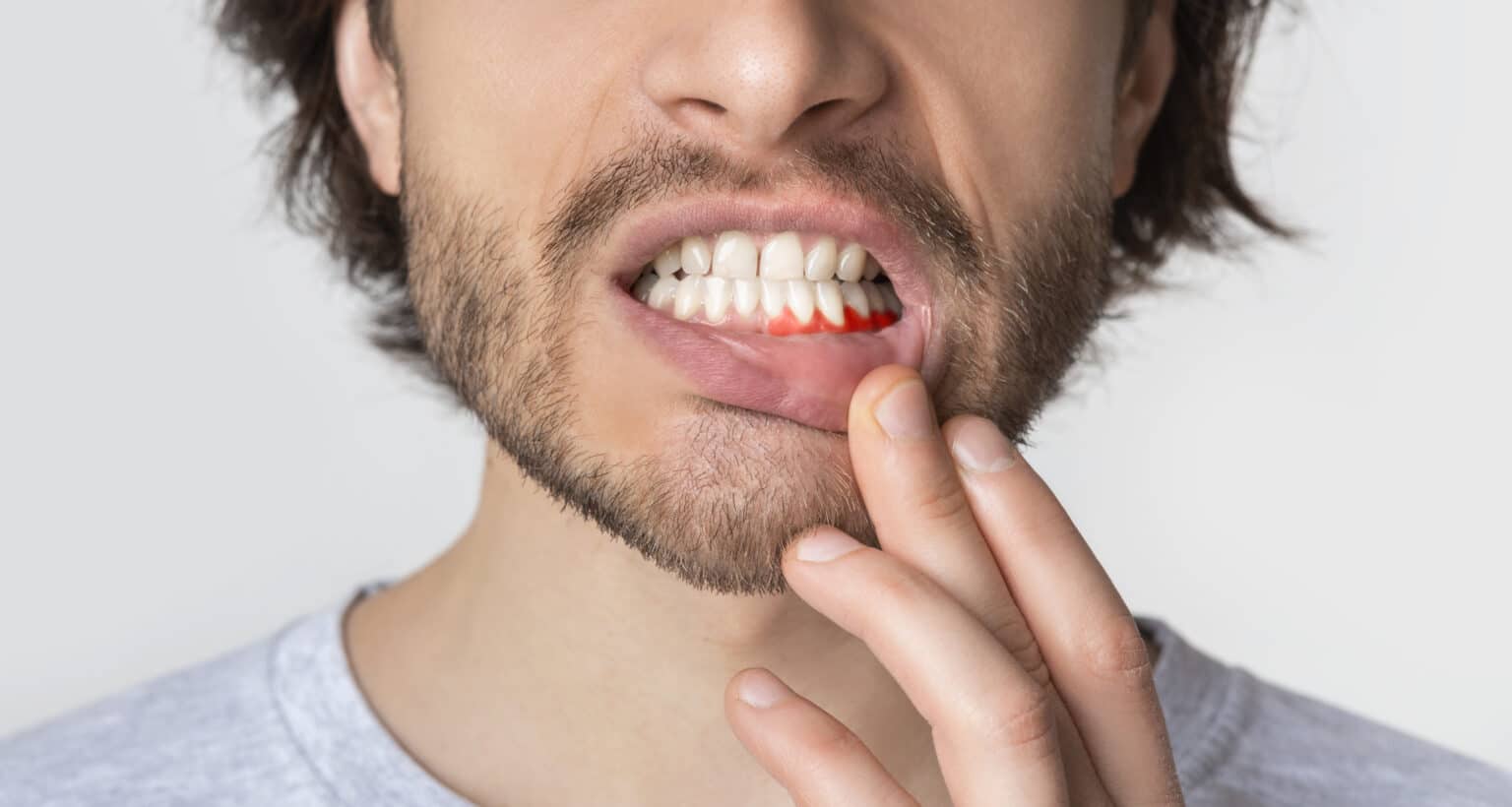 Flossing Blood: Fix Receding Gum Lines