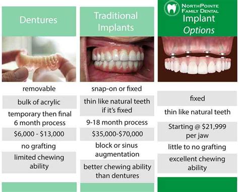 Full Dental Implants Costs