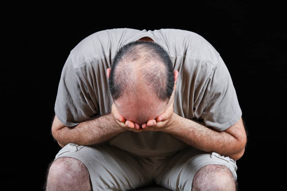 Gluten Sensitivity Hair Loss