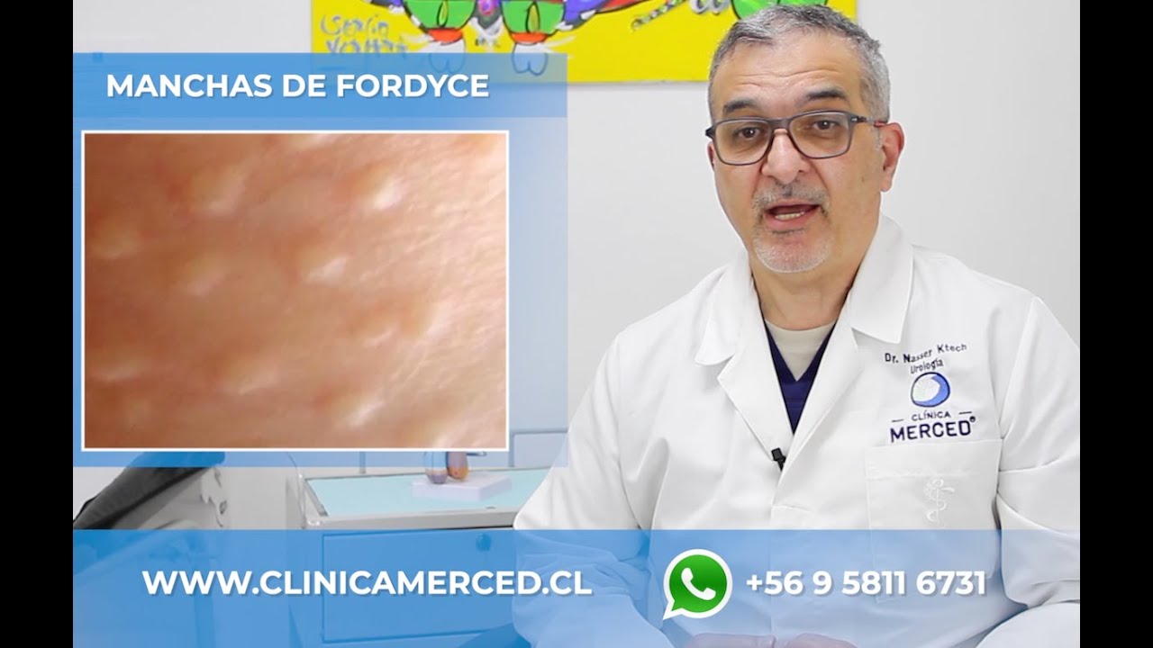 Granos En El Prepucio: Síntomas Y Soluciones Naturales