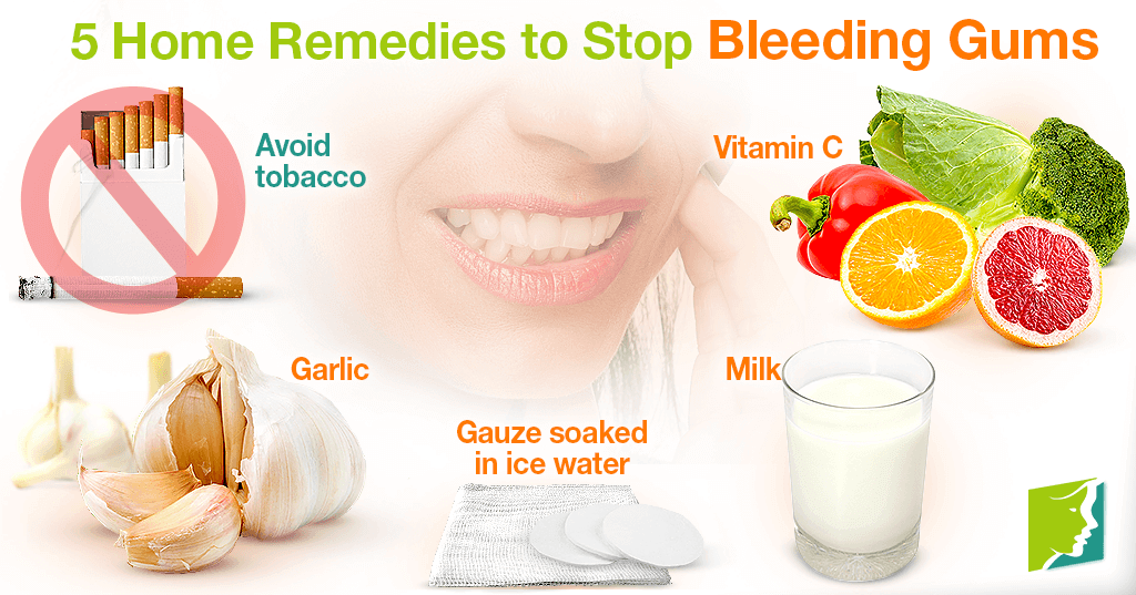 Gum Cuts: Stop Bleeding With Simple Home Remedies