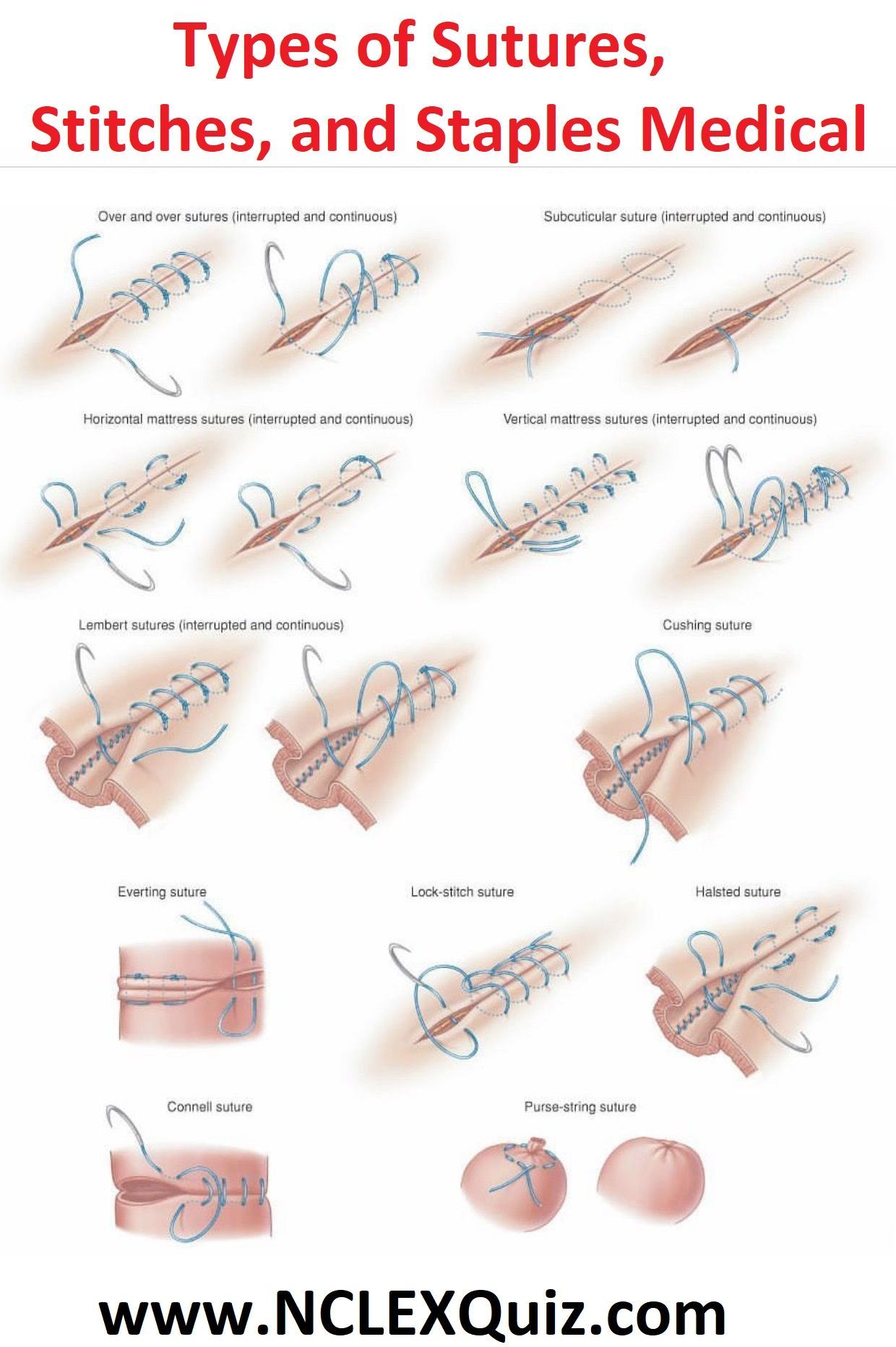 Healing Stitches On Face