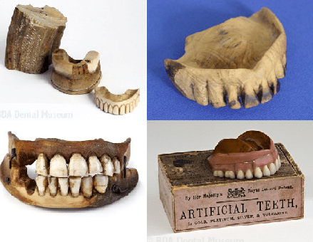History Of Dentures