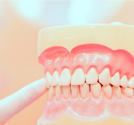 How Do I Find Emergency Denture Repair Near Me? Quick Solutions