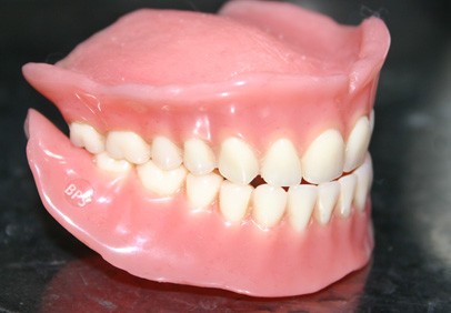 How Much Do Snapin Dentures Cost? Insurance Coverage Guide