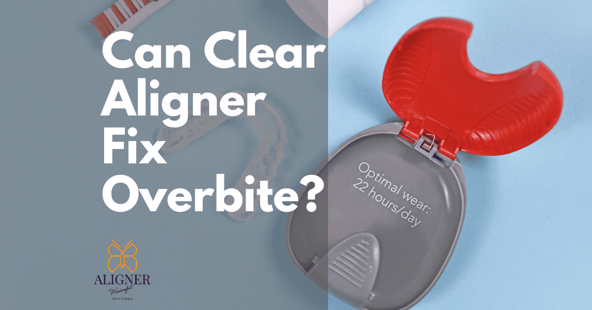 How To Fix Overbite? Aligner Solutions Ahead