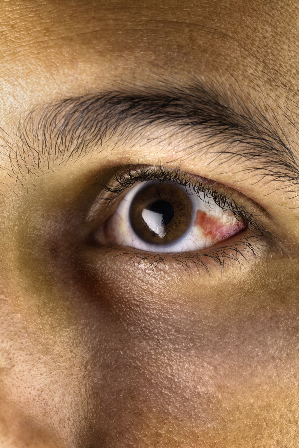 How To Heal Broken Lip Blood Vessel? Natural Remedies