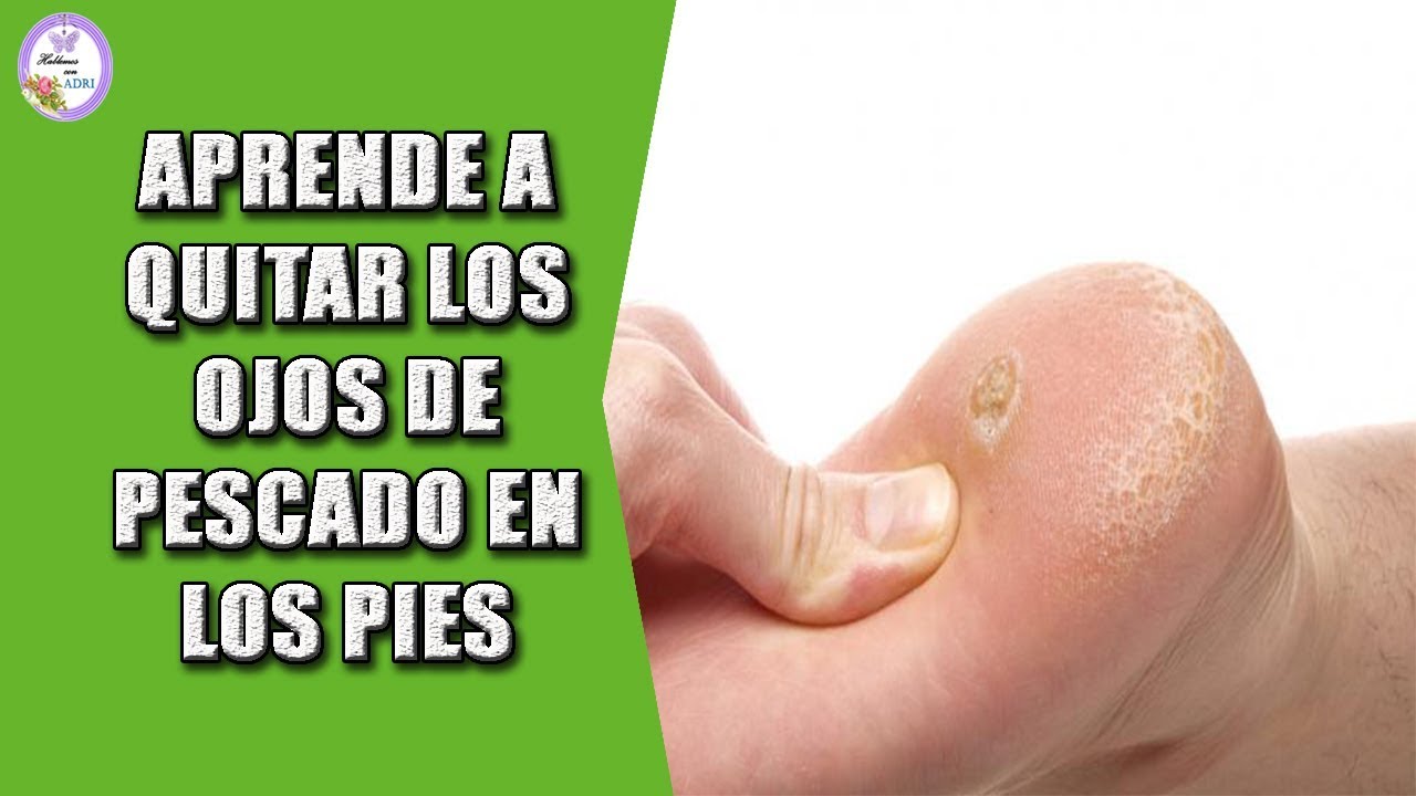 How To Make Ojo De Pescado Pie? Simple Recipes