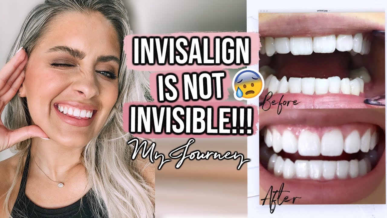How To Shave Down Teeth? Easy Smile Solution How To Shave Down Teeth? Easy Smile Solution