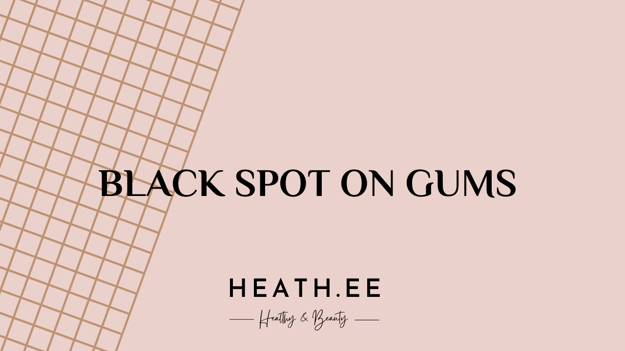 How To Treat Black Spot On Gums? Fast Relief Solutions