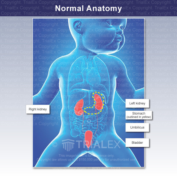Kidney Issues In Fetus