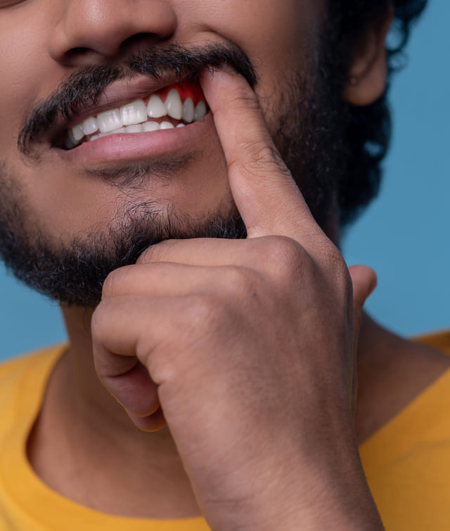 Laser Assisted Periodontal Therapy
