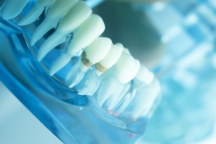 Laser Therapy For Gum Disease: Save Your Teeth