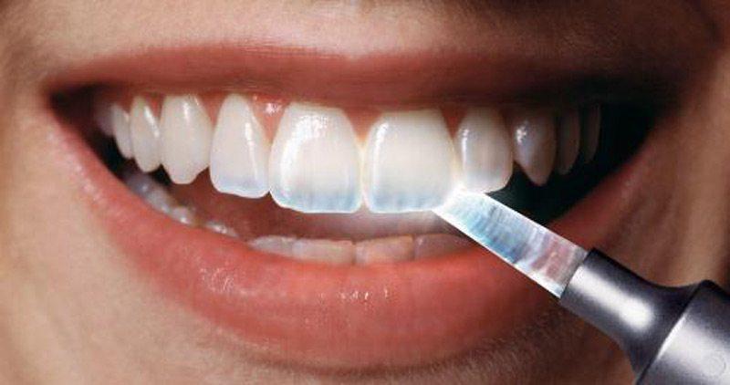 Lines In Tooth Enamel