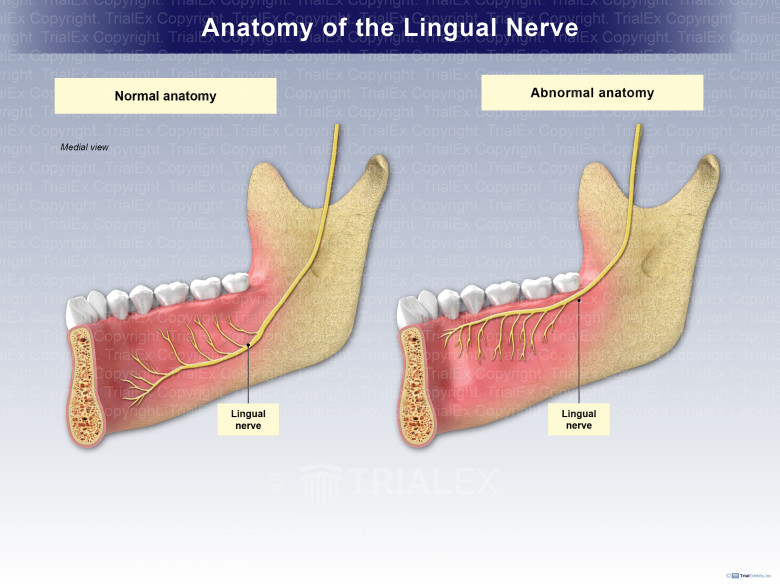 Living With Lingual Nerve Damage Living With Lingual Nerve Damage