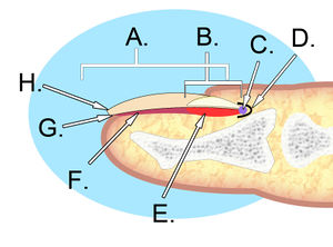 Nail Avulsion Meaning