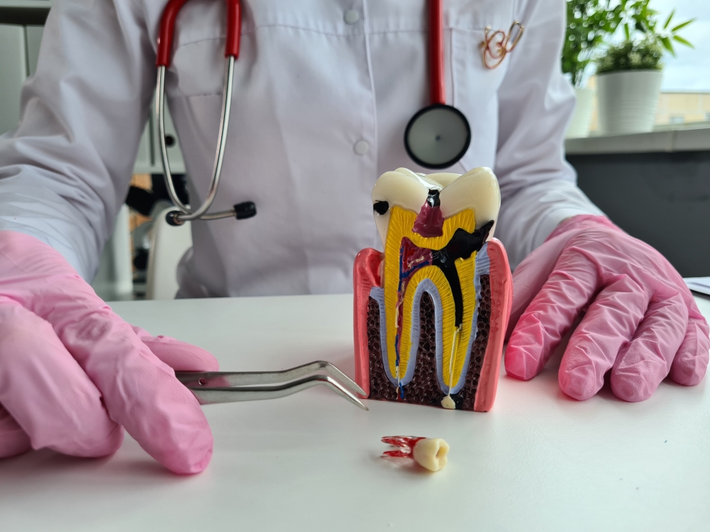Nerve Extraction From Tooth