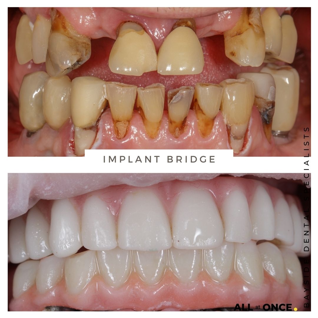 Orthodontist: Expert Smiles In 23 Years