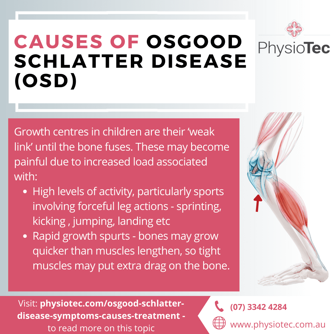 Osgood Schlatter Disease Causes Revealed