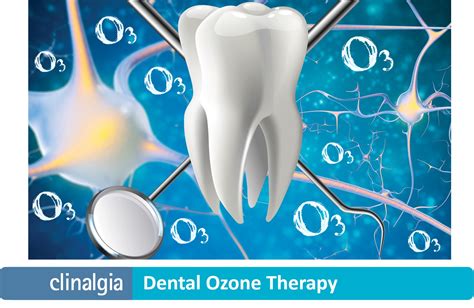 Ozone Therapy Tooth