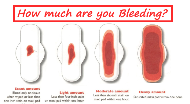 Pcos Blood Clots During Period
