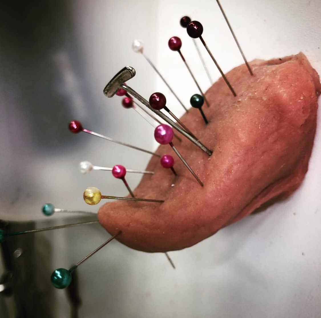 Pins And Needles After Surgery