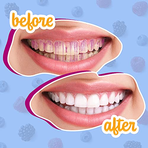 Plaque Disclosing Tablets Dental Disclosing Tablets A Teeth Coloring Plaque Disclosing Tablets Dental Disclosing Tablets A Teeth Coloring