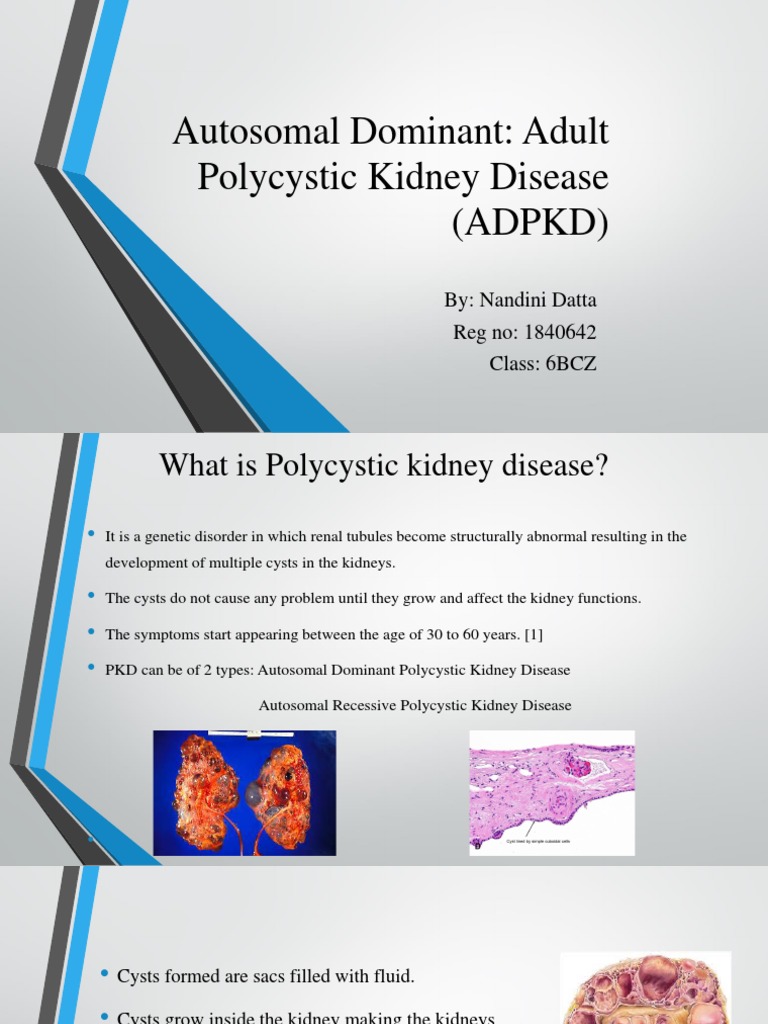 Polycystic Kidney Overview: Diagnosis Explained