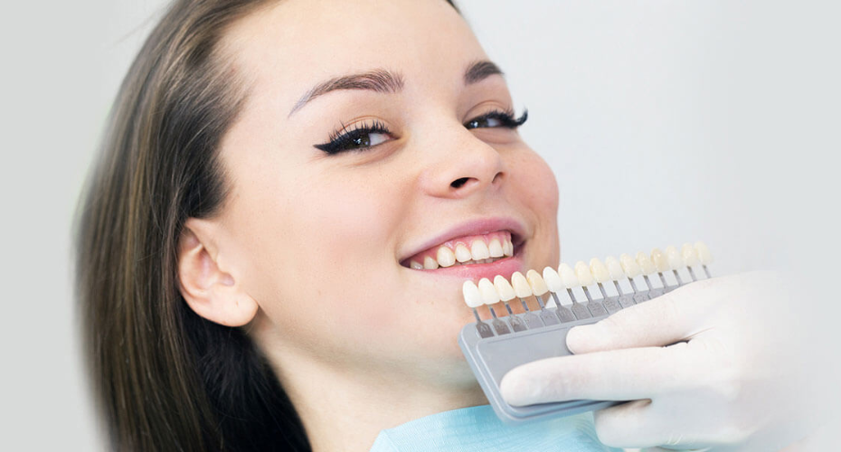 Porcelain Vs Composite Veneers When Is A Dental Veneer The Right Choice Porcelain Vs Composite Veneers When Is A Dental Veneer The Right Choice