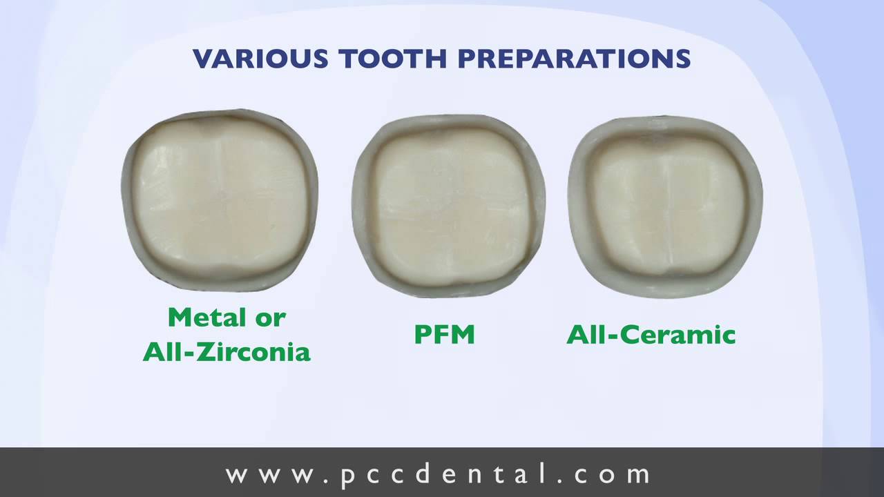 Preparation Of Crown Preparation Of Crown