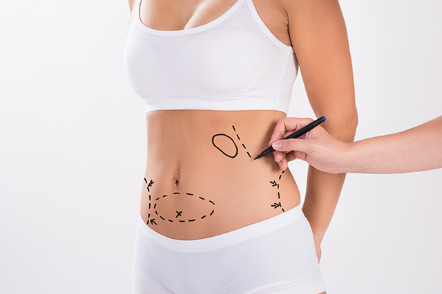 Recovery After Liposuction Recovery After Liposuction