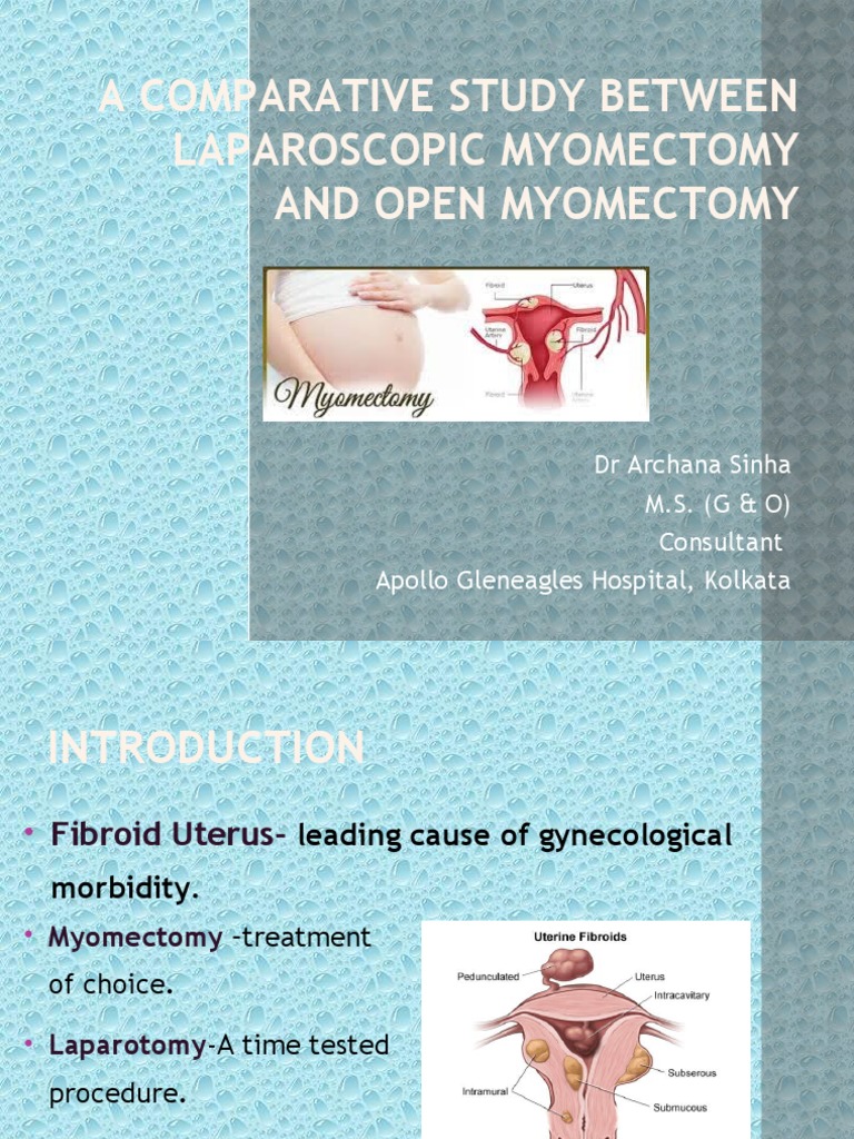 Recovery From Open Myomectomy