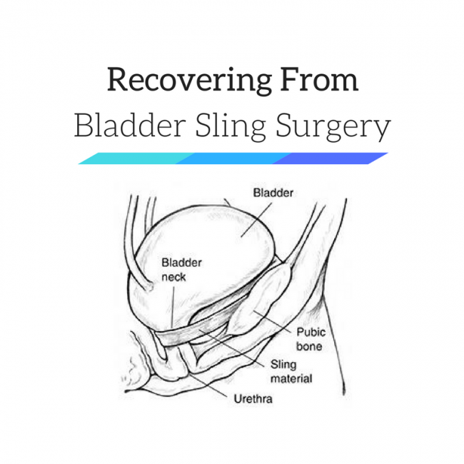 Recovery Time For Bladder Sling