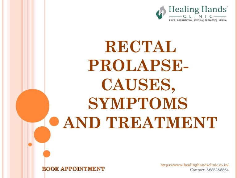 Rectal Prolapse Photos: Understand Symptoms And Treatment