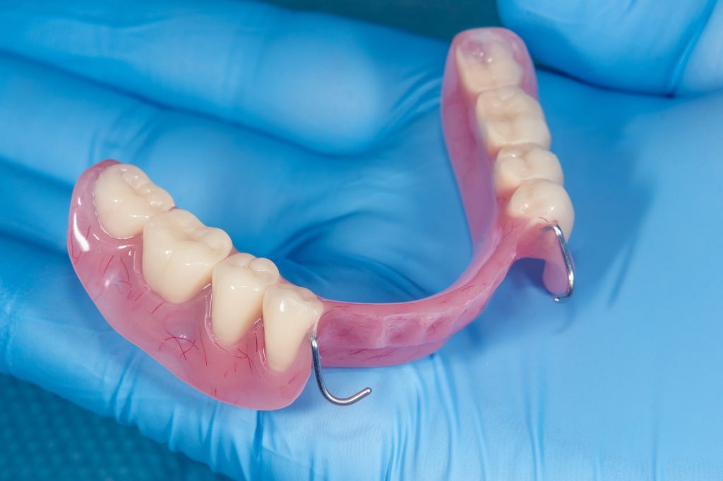 Removable Bridges For Teeth