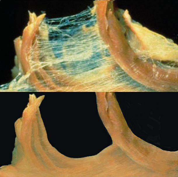 Scar Tissue Inside Lip