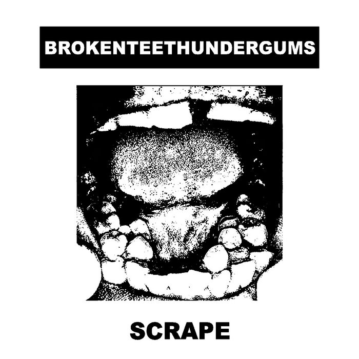 Scrape On Gums