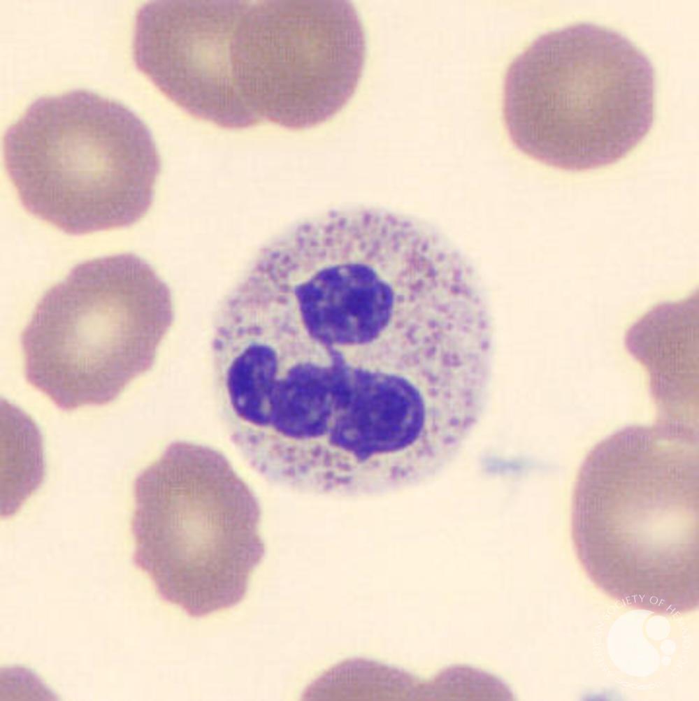 Segmented Neutrophil Percentage
