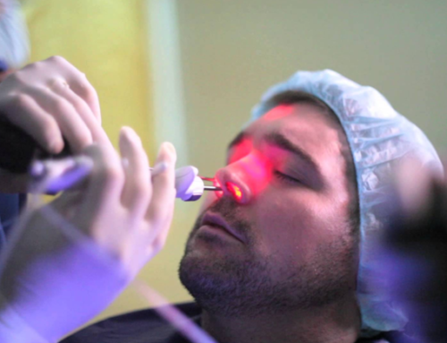 Septoplasty Aftercare: Speed Up Your Recovery