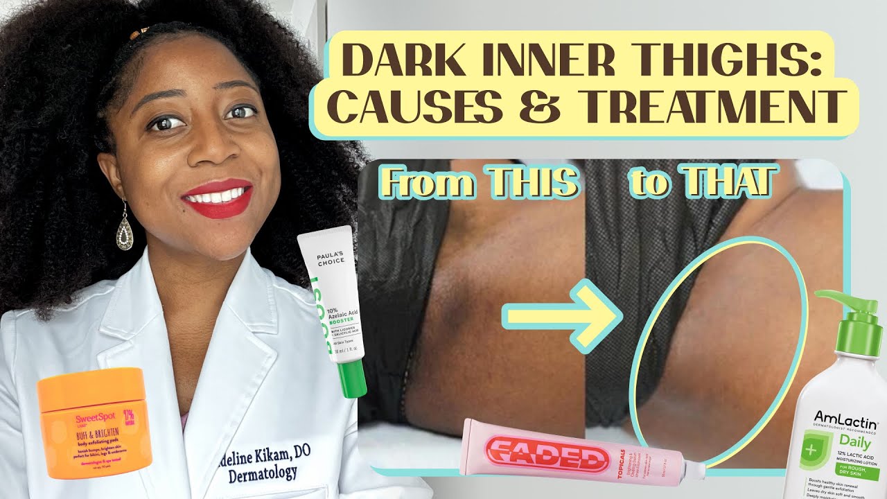 Skin Darkening Inner Thighs