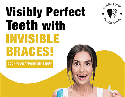 Substitute For Braces