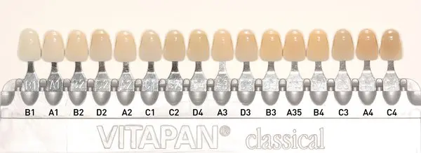Teeth Colour Guide: Healthy Shades