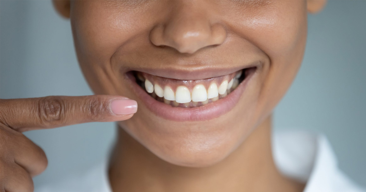 Teeth Craze Lines Causes