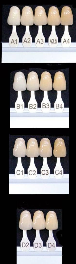 Teeth Shades: Discover Best Color For Your Skin Tone Teeth Shades: Discover Best Color For Your Skin Tone