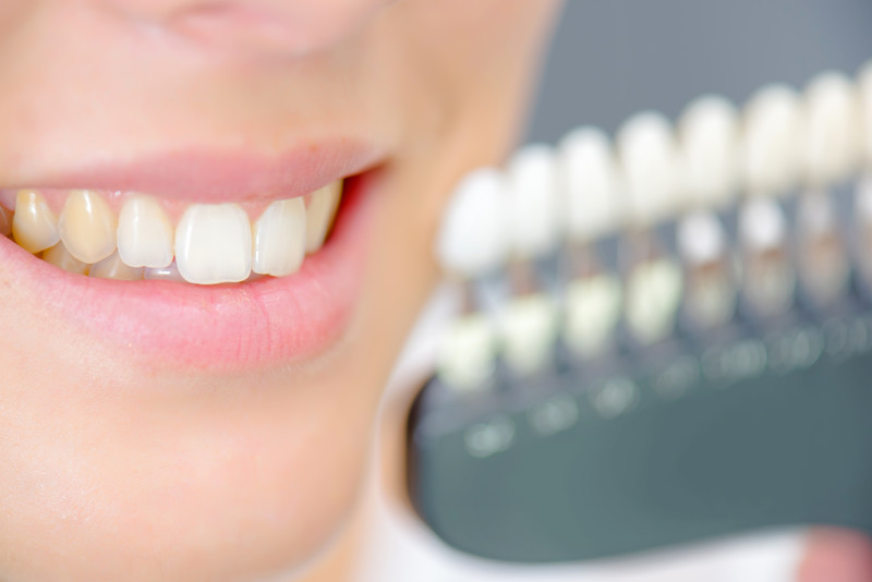 Teeth Stains From Braces
