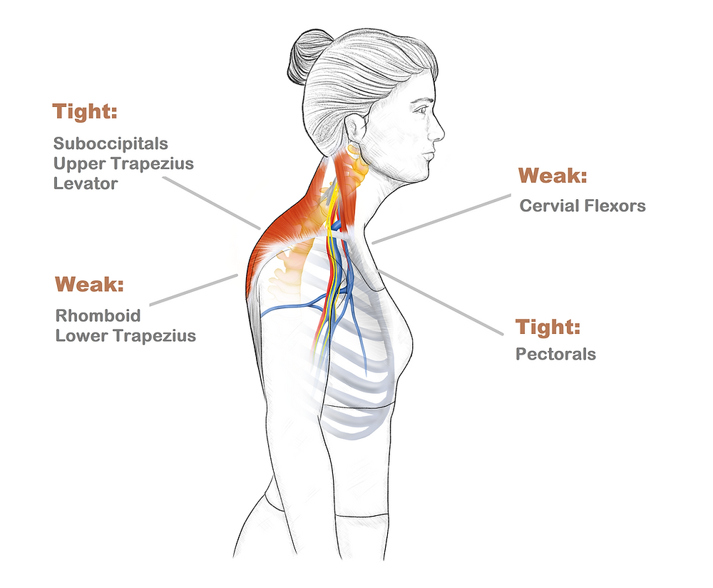 Thoracic Outlet Stretches: Relieve Pain Fast Thoracic Outlet Stretches: Relieve Pain Fast