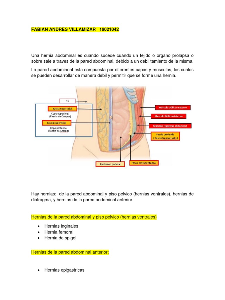 Tipos De Hernias Abdominales