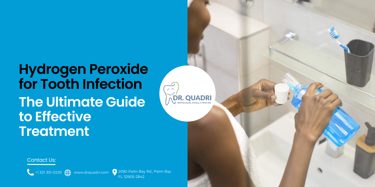 Tooth Decay Hydrogen Peroxide