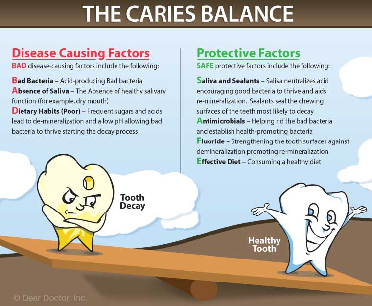 Tooth Decay Prevention Dr E Cosmetic Family Dentistry Tooth Decay Prevention Dr E Cosmetic Family Dentistry
