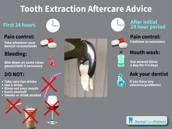 Tooth Extraction Pain Meds